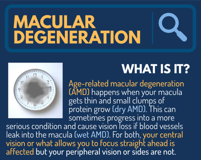 Florida Pre-Med Scholarship Entry | Macular Degeneration, What Is It?